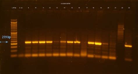 Agarose Gel Electrophoresis For Amplified Pcr Products Of Gstm Bp