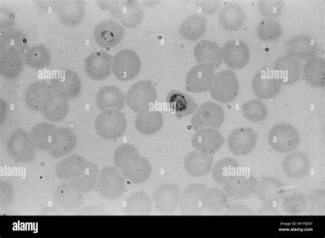 Microfotografía De Un Plasmodium Falciparum Schizont Inmaduros Y Forma Un Anillo Partes Del