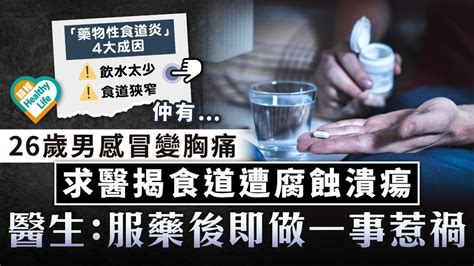 服藥危機｜26歲男感冒變胸痛 求醫揭食道遭腐蝕潰瘍 醫生：服藥後即做一事惹禍 晴報 健康 生活健康 D230916