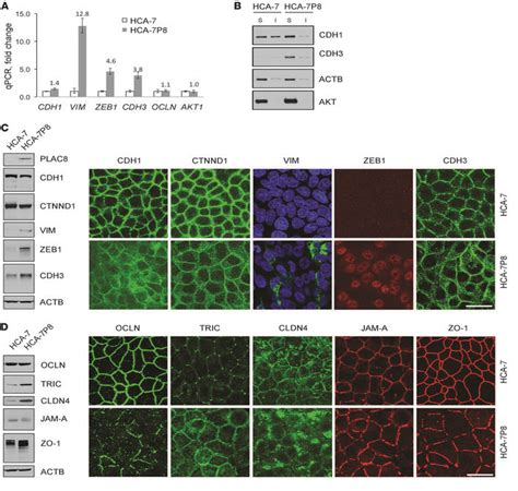 Jci Excess Plac Promotes An Unconventional Erk Dependent Emt In