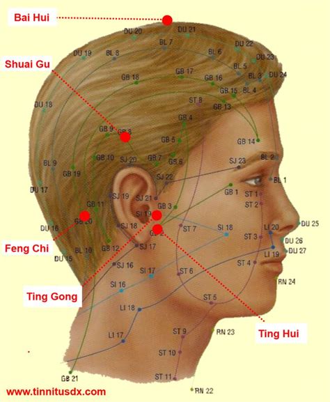 Tinnitus Acupressure Points Bai Hui Gv Tinnitus Ear Ringing Feng Shi