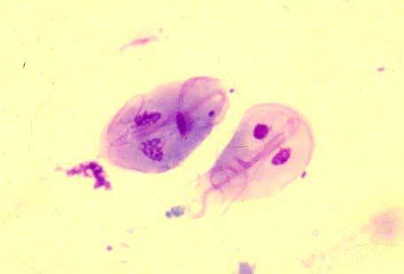 Medical School • Giardia lamblia is a flagellated protozoan...