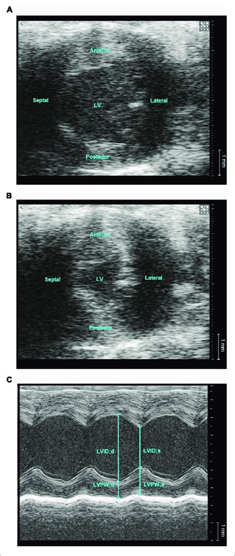 Representative Echocardiographic Images Of Left Ventricle In A