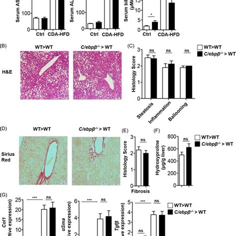 Diet‐induced Steatohepatitis And Liver Fibrosis In Immune Cell