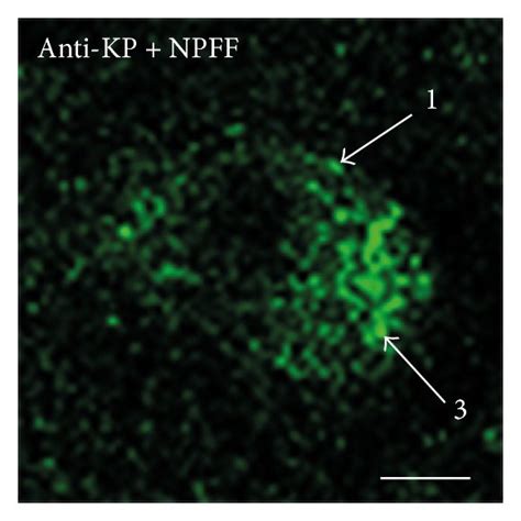 Double Labeling Immunofluorescence Demonstrating Colocalization Of Kp Download Scientific