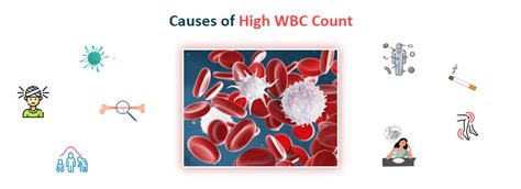 Know The Causes, Symptoms and Management of Elevated and High WBC Count | Ganesh Diagnostic