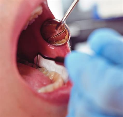 El Dentista Examina La Boca Del Paciente Foto Premium