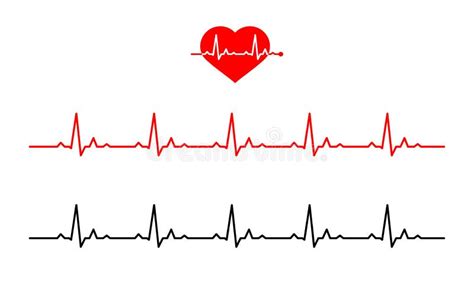 Lijnhartslag Ecg Of Ekg Cardiogram Op Monitor Medische Analyse