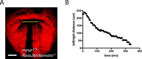 Figures And Data In Live Imaging Of Heart Tube Development In Mouse