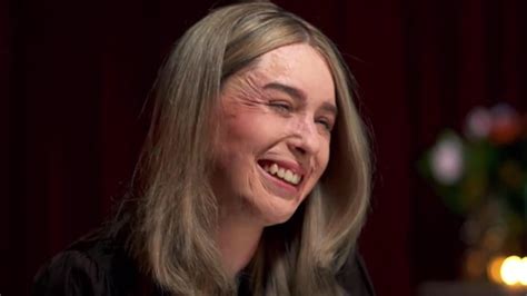 White Island Volcano Survivor Stephanie Browitt Removes Her Mask The