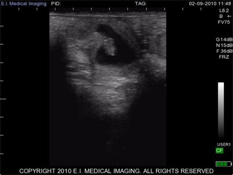 Ibex® Ultrasound Stages Of Early Bovine Pregnancy Part 1