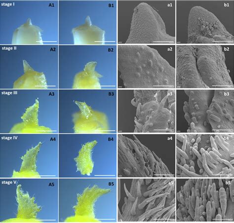 Five Stages Of Trichomes Morphological Development A1 A5 And A1 A5 Download Scientific