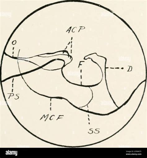 Roentgen Diagnosis Of Diseases Of The Head Fig 49 A