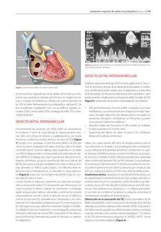 Ecocardiografia Guch Pdf