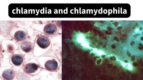 Chlamydia And Chlamydophila Biology Notes Online