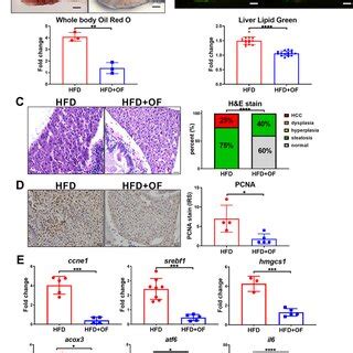 Oligofucoidan Exhibits Antilipid Accumulation And Antihcc Effect In