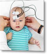 Baby Hearing Test Photograph By Peakstock Science Photo Library