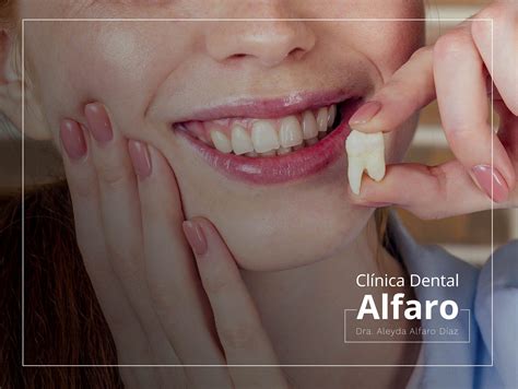 Extracción tercer molar o muela del juicio Clínica Dental Alfaro