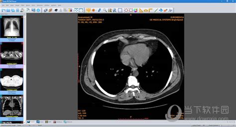 Radiant Dicom Viewer中文版radiant Dicom Viewer医学图像查看器 V403 汉化版下载当下软件园