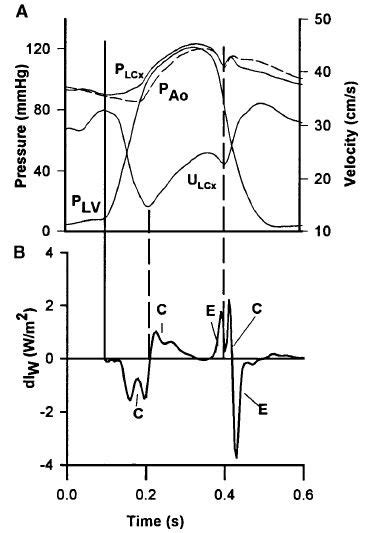 14 A Lcx Coronary Flow Velocity Ulcx And Pressure Plcx Aortic