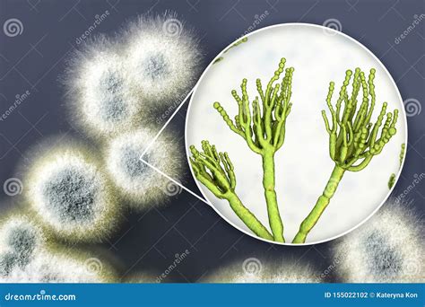 Penicillium Mold Fungi, Illustration And Photo Of Colony Grown On Nutrient Medium Royalty-Free ...