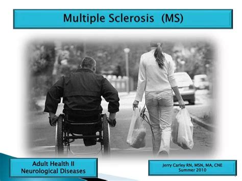 Ppt Multiple Sclerosis Ms Powerpoint Presentation Free Download