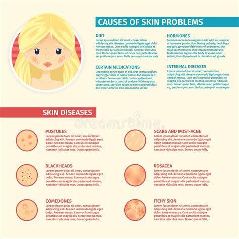 Infographics Of Skin Problems The Causes Of Problem Skin Types Of