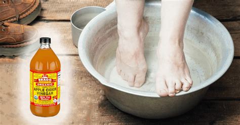 Detoxify And Heal The Body With This Apple Cider Vinegar Detox Foot Soak Foot Detox Soak Foot