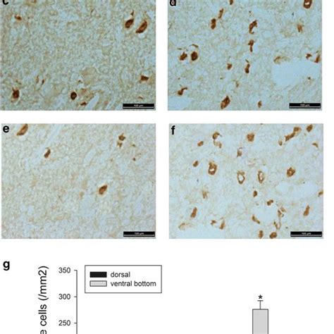 Immunohistochemical Expression Of PRDM5 In Adult Rat Spinal Cord 2 Mm