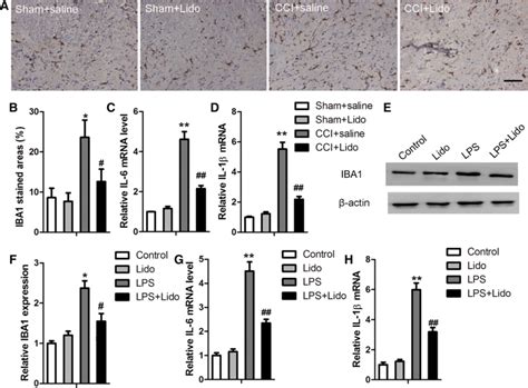 Inhibitory Effect Of Lidocaine On Microglia In CCI Rats And