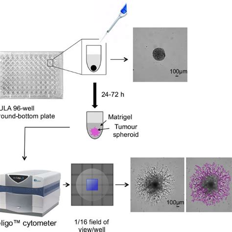 Schematic Overview Of 3d Tumor Spheroid Invasion Assay The Workflow Download Scientific