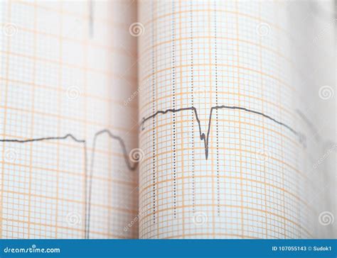 Ecg Graph Paper As A Health Background With Space For Your Insertion