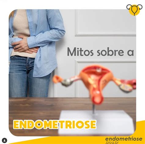 Mitos Sobre A Endometriose