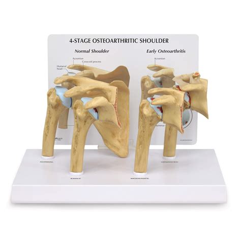 Buy Gpi Anatomicals Shoulder Joint Model Set Human Body Anatomy