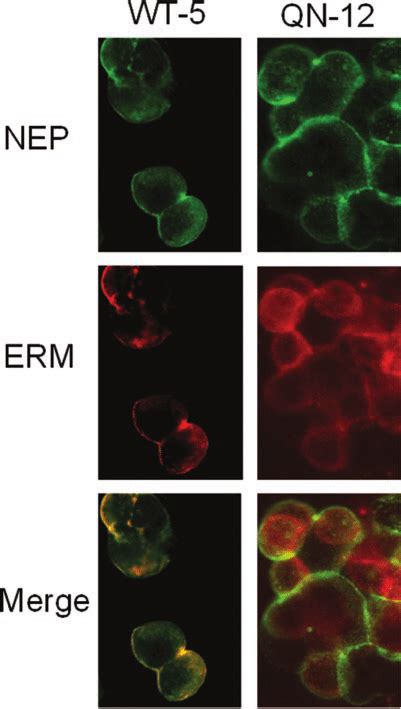 Immunofluorescence Localization Of Wild Type Nep And Site Directed