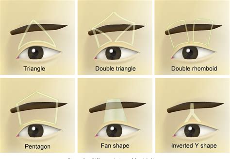 Figure From Intra Eyebrow Frontalis Suspension Using Inverted Y