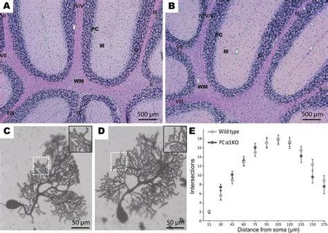 Overall Cerebellar And Purkinje Cell Morphology In Young Cacna1a