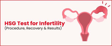 Hsg Test For Infertility Procedure Recovery And Results