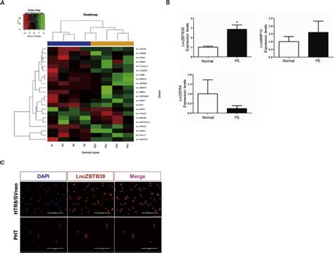 Upregulated Lnczbtb In Pre Eclampsia And Its Effects On Trophoblast