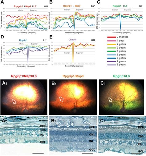 Longitudinal Evaluation Of Onl Thickness And Retinal Histology In Download Scientific Diagram