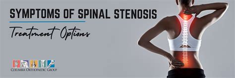 Spinal Stenosis Symptoms Treatment And More Spinal Stenosis Mi