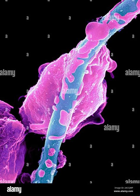 Yeast Infecting A Granulocyte Coloured Scanning Electron Micrograph