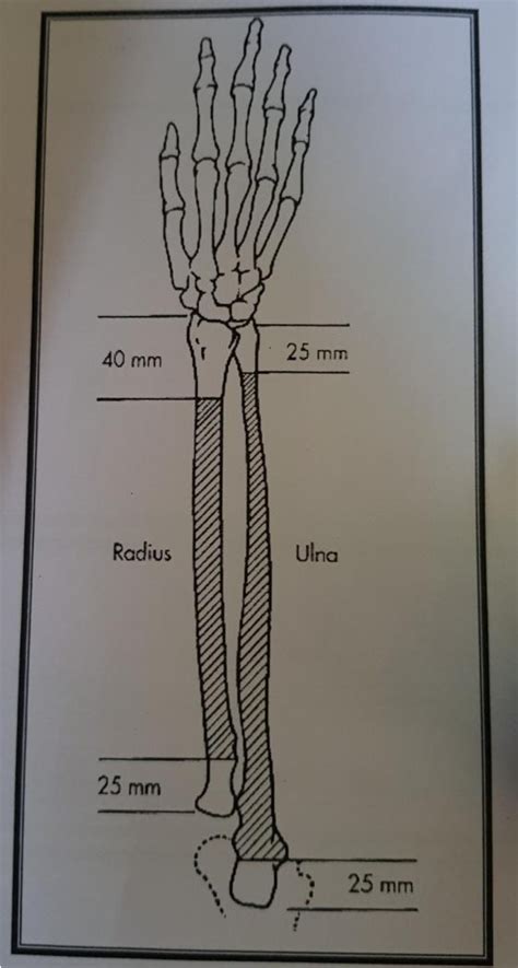 Blank Ulna Diagram