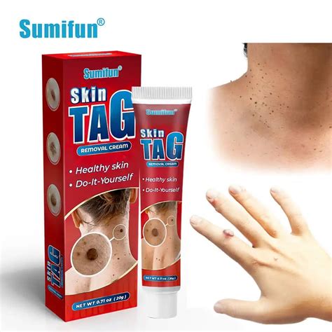 Skin Tag Removal Cream | Ginax Store