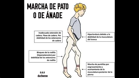 Tipos De Marchas Semiologia Youtube