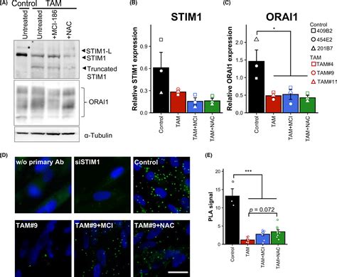 Antioxidants Restore Storeoperated Ca2 Entry In PatientiPSCderived