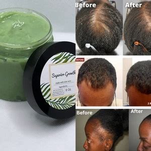 Superior Growth Grease, All Natural Hair Grease,aloe Vera Hair Grease ...