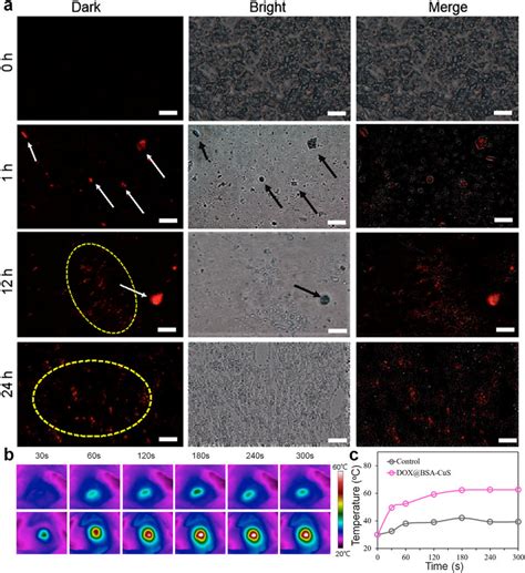 In Vivo Investigation Of Dox Delivery And Photothermal Performance Of