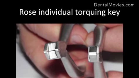 Practical Wire Bending Tips In Contemporary Orthodontics For Ideal Case