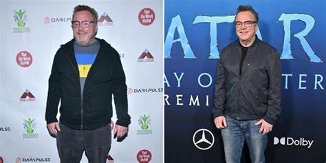 Tom Arnold On How He ‘cheated Death Lost 80 Pounds After Meeting Life